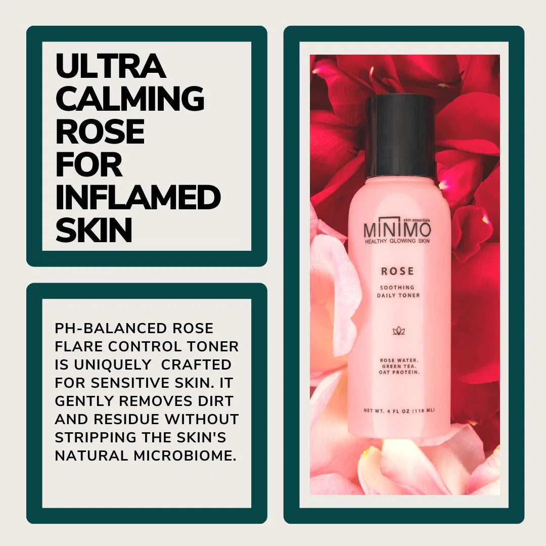 Rose Soothing Flare Control Toner - Minimo Skin Essentials